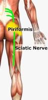 Piriformis